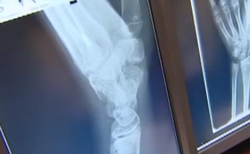 Korszerű radiológiai rendszert helyeztek működésbe Újbudán