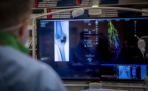 Kisebb terheléssel, pontosabb eredménnyel jár a magyar találmány használata 